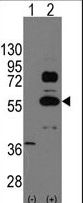 SOX9 Antibody - Western blot of SOX9 (arrow) using rabbit polyclonal SOX9 Antibody. 293 cell lysates (2 ug/lane) either nontransfected (Lane 1) or transiently transfected with the SOX9 gene (Lane 2) (Origene Technologies).