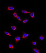 SOX9 Antibody - Immunofluorescence of anti-SOX9 Antibody in HeLa cells. 0.025 mg/ml primary antibody was followed by Alexa-Fluor-546-conjugated donkey anti-rabbit lgG (H+L). Alexa-Fluor-546 emits orange fluorescence. Blue counterstaining is DAPI.