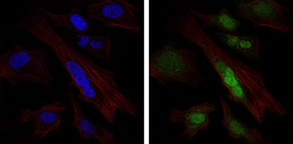 SOX9 Antibody - Immunofluorescence of HeLa cells using SOX9 mouse monoclonal antibody (green). Blue: DRAQ5 fluorescent DNA dye. Red: Actin filaments have been labeled with Alexa Fluor-555 phalloidin.