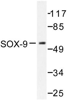 SOX9 Antibody - Western blot of SOX-9 (Q175) pAb in extracts from 293 cells treated with PBS 60'.