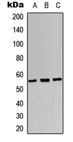SOX9 Antibody - Western blot analysis of SOX9 expression in HepG2 (A); HeLa (B); NIH3T3 (C) whole cell lysates.