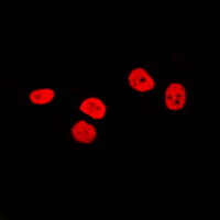 SOX9 Antibody - Immunofluorescent analysis of SOX9 staining in HepG2 cells. Formalin-fixed cells were permeabilized with 0.1% Triton X-100 in TBS for 5-10 minutes and blocked with 3% BSA-PBS for 30 minutes at room temperature. Cells were probed with the primary antibody in 3% BSA-PBS and incubated overnight at 4 deg C in a humidified chamber. Cells were washed with PBST and incubated with a DyLight 594-conjugated secondary antibody (red) in PBS at room temperature in the dark. DAPI was used to stain the cell nuclei (blue).