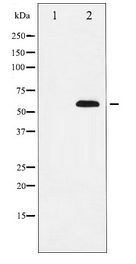 SOX9 Antibody - Western blot of SOX9 expression in NIH-3T3 whole cell lysates,The lane on the left is treated with the antigen-specific peptide.