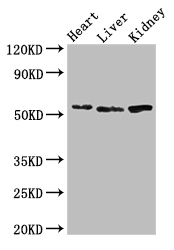 SOX9 Antibody - Positive WB detected in:Mouse heart tissue,Mouse liver tissue,Mouse kidney tissue;All lanes:SOX9 antibody at 3ug/ml;Secondary;Goat polyclonal to rabbit IgG at 1/50000 dilution;Predicted band size: 57 kDa;Observed band size: 57 kDa;