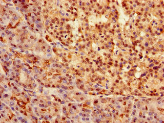 SOX9 Antibody - Immunohistochemistry of paraffin-embedded human pancreatic tissue using SOX9 Antibody at dilution of 1:100