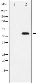 SOX9 Antibody - Western blot analysis of SOX9 expression in NIH-3T3 whole cells lysates. The lane on the left is treated with the antigen-specific peptide.