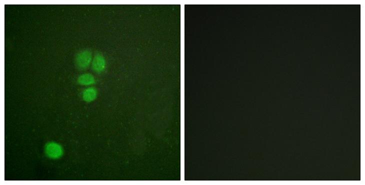 SOX9 Antibody - Peptide - + Immunofluorescence analysis of A549 cells, using SOX-9 (Ab-181) antibody.