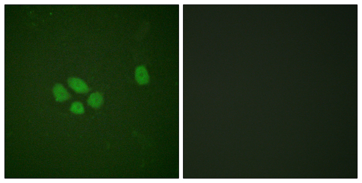 SOX9 Antibody - Immunofluorescence analysis of A549 cells, using SOX-9 (Phospho-Ser181) Antibody. The picture on the right is blocked with the phospho peptide.