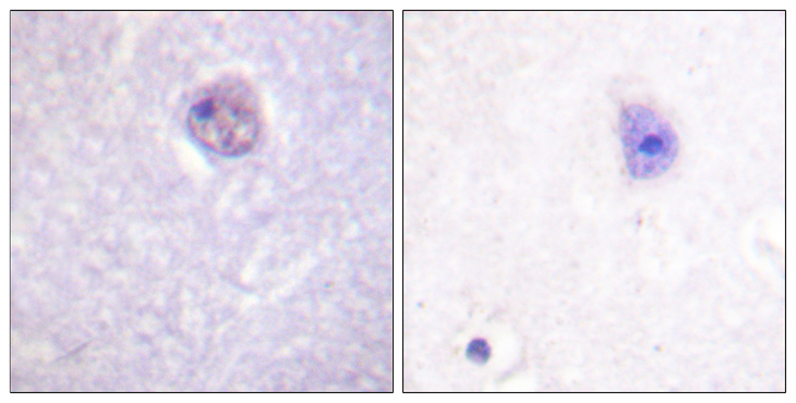 SOX9 Antibody - Immunohistochemistry analysis of paraffin-embedded human brain, using SOX-9 (Phospho-Ser181) Antibody. The picture on the right is blocked with the phospho peptide.