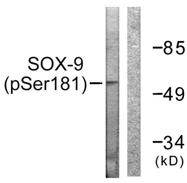 SOX9 Antibody - Western blot analysis of lysates from 293 cells treated with PBS 60', using SOX-9 (Phospho-Ser181) Antibody. The lane on the right is blocked with the phospho peptide.