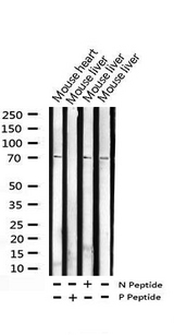 SOX9 Antibody - Western blot analysis of Phospho-SOX-9 (Ser181) expression in various lysates