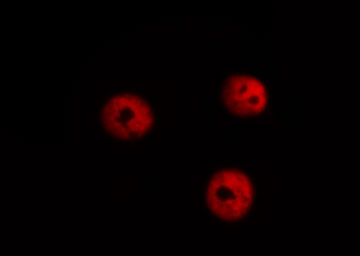 SOX9 Antibody - Staining A549 cells by IF/ICC. The samples were fixed with PFA and permeabilized in 0.1% saponin prior to blocking in 10% serum for 45 min at 37°C. The primary antibody was diluted 1/400 and incubated with the sample for 1 hour at 37°C. A Alexa Fluor 594 conjugated goat polyclonal to rabbit IgG (H+L), diluted 1/600 was used as secondary antibody.