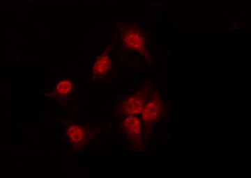 SOX9 Antibody - Staining 293 cells by IF/ICC. The samples were fixed with PFA and permeabilized in 0.1% Triton X-100, then blocked in 10% serum for 45 min at 25°C. The primary antibody was diluted at 1:200 and incubated with the sample for 1 hour at 37°C. An Alexa Fluor 594 conjugated goat anti-rabbit IgG (H+L) Ab, diluted at 1/600, was used as the secondary antibody.