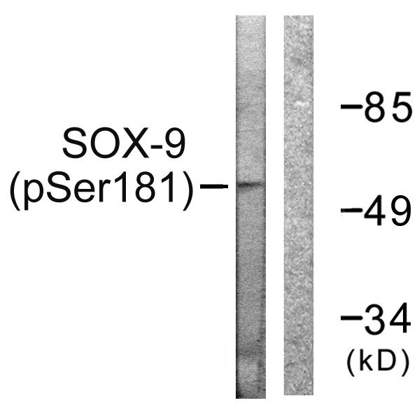SOX9 Antibody - Western blot analysis of extracts from 293 cells, treated with PBS (60mins), using SOX-9 (Phospho-Ser181) antibody.