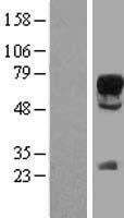 SOX9 Protein - Western validation with an anti-DDK antibody * L: Control HEK293 lysate R: Over-expression lysate