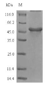 GGH / Gamma-Glutamyl Hydrolase Protein - (Tris-Glycine gel) Discontinuous SDS-PAGE (reduced) with 5% enrichment gel and 15% separation gel.