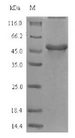 GGH / Gamma-Glutamyl Hydrolase Protein - (Tris-Glycine gel) Discontinuous SDS-PAGE (reduced) with 5% enrichment gel and 15% separation gel.