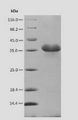 Valosin-Containing Protein (VCP) Protein - (Tris-Glycine gel) Discontinuous SDS-PAGE (reduced) with 5% enrichment gel and 15% separation gel.
