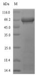 rbcL Protein - (Tris-Glycine gel) Discontinuous SDS-PAGE (reduced) with 5% enrichment gel and 15% separation gel.