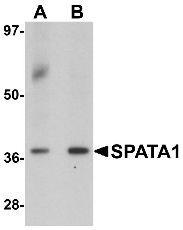 SP-2 / SPATA1 Antibody - Western blot analysis of SPATA1 in A20 cell lysate with SPATA1 antibody at (A) 1 and (B) 2 ug/ml.
