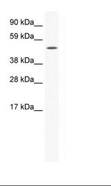 SP1 Antibody - SP2/0 Cell Lysate.  This image was taken for the unconjugated form of this product. Other forms have not been tested.