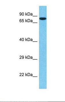 SP1 Antibody - Western blot of Human A549. SP1 antibody dilution 1.0 ug/ml.  This image was taken for the unconjugated form of this product. Other forms have not been tested.
