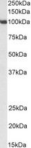 SP1 Antibody - SP1 antibody (0.3 ug/ml) staining of NIH3T3 nuclear lysate (35 ug protein in RIPA buffer). Primary incubation was 1 hour. Detected by chemiluminescence.