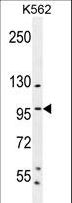 SP1 Antibody - SP1 Antibody (C-term P692) western blot of K562 cell line lysates (35 ug/lane). The SP1 antibody detected the SP1 protein (arrow).
