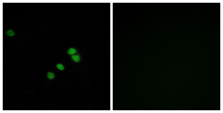 SP1 Antibody - Immunofluorescence analysis of HepG2 cells, using SP1 Antibody. The picture on the right is blocked with the synthesized peptide.