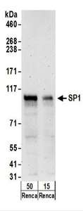 SP1 Antibody - Detection of Mouse SP1 by Western Blot. Samples: Whole cell lysate from Renca (15 and 50 ug) cells. Antibodies: Affinity purified rabbit anti-SP1 antibody used for WB at 0.4 ug/ml. Detection: Chemiluminescence with an exposure time of 3 minutes.