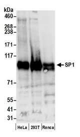 SP1 Antibody - Detection of human and mouse SP1 by western blot. Samples: Whole cell lysate (50 µg) from HeLa, HEK293T, and mouse Renca cells prepared using NETN lysis buffer. Antibody: Affinity purified rabbit anti-SP1 antibody used for WB at 0.1 µg/ml. Detection: Chemiluminescence with an exposure time of 10 seconds.