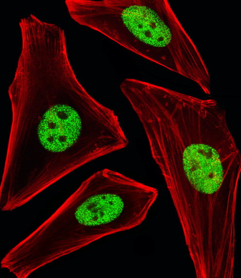 SP1 Antibody - Fluorescent image of HeLa cells stained with SP1 Antibody. Antibody was diluted at 1:25 dilution. An Alexa Fluor 488-conjugated goat anti-mouse lgG at 1:400 dilution was used as the secondary antibody (green). Cytoplasmic actin was counterstained with Alexa Fluor 555 conjugated with Phalloidin (red).