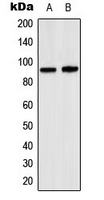 SP1 Antibody - Western blot analysis of SP1 expression in K562 (A); A431 (B) whole cell lysates.