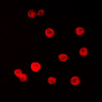 SP1 Antibody - Immunofluorescent analysis of SP1 staining in K562 cells. Formalin-fixed cells were permeabilized with 0.1% Triton X-100 in TBS for 5-10 minutes and blocked with 3% BSA-PBS for 30 minutes at room temperature. Cells were probed with the primary antibody in 3% BSA-PBS and incubated overnight at 4 C in a humidified chamber. Cells were washed with PBST and incubated with a DyLight 594-conjugated secondary antibody (red) in PBS at room temperature in the dark. DAPI was used to stain the cell nuclei (blue).