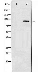 SP1 Antibody - Western blot of SP1 expression in LOVO whole cell lysates,The lane on the left is treated with the antigen-specific peptide.