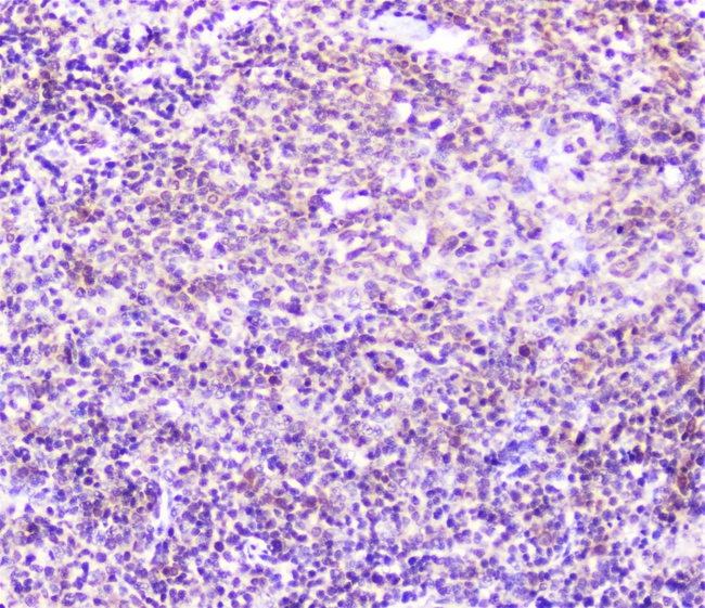 SP1 Antibody - IHC analysis of SP1 using anti-SP1 antibody. SP1 was detected in paraffin-embedded section of rat spleen tissue. Heat mediated antigen retrieval was performed in citrate buffer (pH6, epitope retrieval solution) for 20 mins. The tissue section was blocked with 10% goat serum. The tissue section was then incubated with 2µg/ml rabbit anti-SP1 Antibody overnight at 4°C. Biotinylated goat anti-rabbit IgG was used as secondary antibody and incubated for 30 minutes at 37°C. The tissue section was developed using Strepavidin-Biotin-Complex (SABC) with DAB as the chromogen.