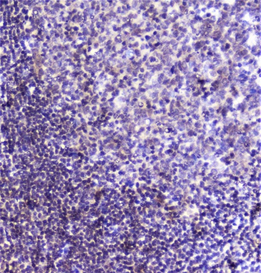 SP1 Antibody - IHC analysis of SP1 using anti-SP1 antibody. SP1 was detected in paraffin-embedded section of human tonsil tissue. Heat mediated antigen retrieval was performed in citrate buffer (pH6, epitope retrieval solution) for 20 mins. The tissue section was blocked with 10% goat serum. The tissue section was then incubated with 2µg/ml rabbit anti-SP1 Antibody overnight at 4°C. Biotinylated goat anti-rabbit IgG was used as secondary antibody and incubated for 30 minutes at 37°C. The tissue section was developed using Strepavidin-Biotin-Complex (SABC) with DAB as the chromogen.