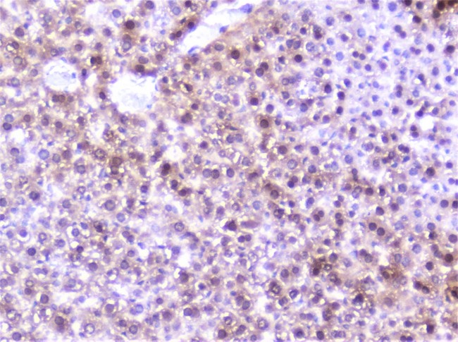 SP1 Antibody - IHC analysis of SP1 using anti-SP1 antibody. SP1 was detected in paraffin-embedded section of mouse liver tissue. Heat mediated antigen retrieval was performed in citrate buffer (pH6, epitope retrieval solution) for 20 mins. The tissue section was blocked with 10% goat serum. The tissue section was then incubated with 2µg/ml rabbit anti-SP1 Antibody overnight at 4°C. Biotinylated goat anti-rabbit IgG was used as secondary antibody and incubated for 30 minutes at 37°C. The tissue section was developed using Strepavidin-Biotin-Complex (SABC) with DAB as the chromogen.