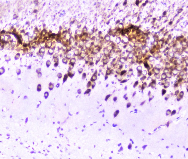 SP1 Antibody - IHC analysis of SP1 using anti-SP1 antibody. SP1 was detected in paraffin-embedded section of rat brain tissue. Heat mediated antigen retrieval was performed in citrate buffer (pH6, epitope retrieval solution) for 20 mins. The tissue section was blocked with 10% goat serum. The tissue section was then incubated with 2µg/ml rabbit anti-SP1 Antibody overnight at 4°C. Biotinylated goat anti-rabbit IgG was used as secondary antibody and incubated for 30 minutes at 37°C. The tissue section was developed using Strepavidin-Biotin-Complex (SABC) with DAB as the chromogen.