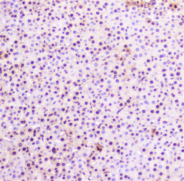 SP1 Antibody - IHC analysis of SP1 using anti-SP1 antibody. SP1 was detected in paraffin-embedded section of rat liver tissue. Heat mediated antigen retrieval was performed in citrate buffer (pH6, epitope retrieval solution) for 20 mins. The tissue section was blocked with 10% goat serum. The tissue section was then incubated with 2µg/ml rabbit anti-SP1 Antibody overnight at 4°C. Biotinylated goat anti-rabbit IgG was used as secondary antibody and incubated for 30 minutes at 37°C. The tissue section was developed using Strepavidin-Biotin-Complex (SABC) with DAB as the chromogen.