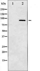 SP1 Antibody - Western blot analysis of SP1 expression in LOVO cells whole cells lysates. The lane on the left is treated with the antigen-specific peptide.