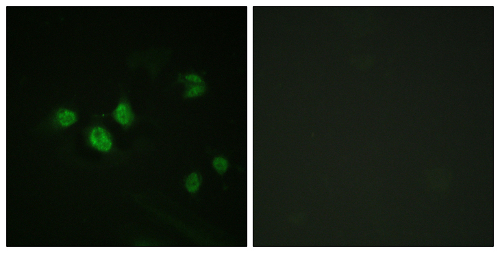 SP1 Antibody - Immunofluorescence analysis of HeLa cells, using SP1 (Phospho-Thr453) Antibody. The picture on the right is blocked with the phospho peptide.