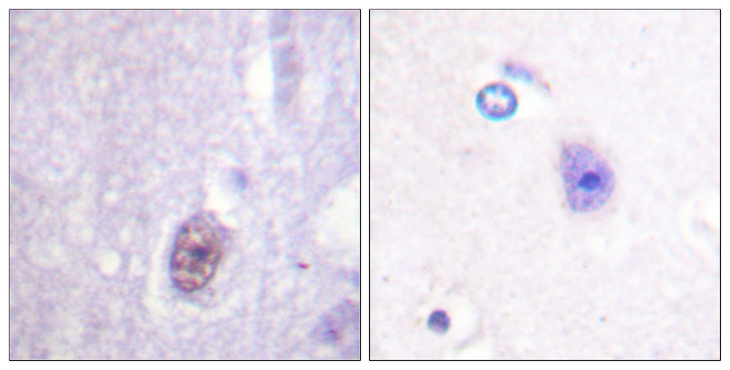 SP1 Antibody - Immunohistochemistry analysis of paraffin-embedded human brain, using SP1 (Phospho-Thr453) Antibody. The picture on the right is blocked with the phospho peptide.