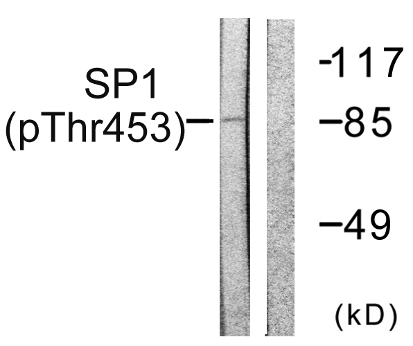 SP1 Antibody - Western blot analysis of lysates from A549 cells, using SP1 (Phospho-Thr453) Antibody. The lane on the right is blocked with the phospho peptide.