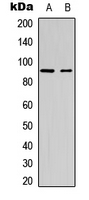 SP1 Antibody - Western blot analysis of SP1 (pT453) expression in Jurkat (A); mouse melanoma cancer (B) whole cell lysates.