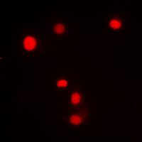SP1 Antibody - Immunofluorescent analysis of SP1 (pT453) staining in Jurkat cells. Formalin-fixed cells were permeabilized with 0.1% Triton X-100 in TBS for 5-10 minutes and blocked with 3% BSA-PBS for 30 minutes at room temperature. Cells were probed with the primary antibody in 3% BSA-PBS and incubated overnight at 4 deg C in a humidified chamber. Cells were washed with PBST and incubated with a DyLight 594-conjugated secondary antibody (red) in PBS at room temperature in the dark. DAPI was used to stain the cell nuclei (blue).