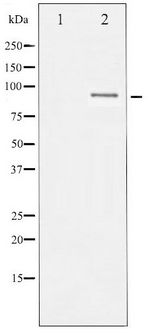 SP1 Antibody - Western blot of SP1 phosphorylation expression in A549 whole cell lysates,The lane on the left is treated with the antigen-specific peptide.