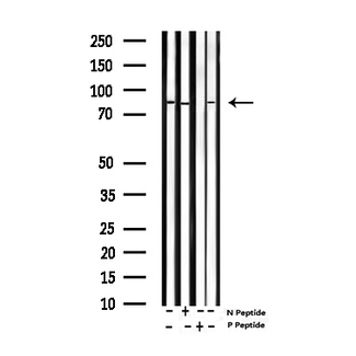 SP1 Antibody - Western blot analysis of Phospho-SP1 (Thr453) expression in various lysates