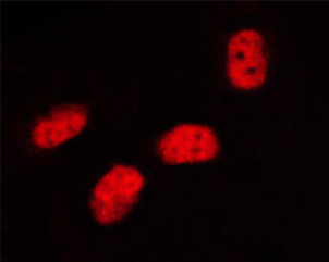 SP1 Antibody - Staining HeLa cells by IF/ICC. The samples were fixed with PFA and permeabilized in 0.1% saponin prior to blocking in 10% serum for 45 min at 37°C. The primary antibody was diluted 1/400 and incubated with the sample for 1 hour at 37°C. A Alexa Fluor® 594 conjugated goat polyclonal to rabbit IgG (H+L), diluted 1/600 was used as secondary antibody.
