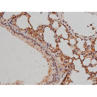 SP1 Antibody - 1:200 staining mouse lung tissue by IHC-P. The tissue was formaldehyde fixed and a heat mediated antigen retrieval step in citrate buffer was performed. The tissue was then blocked and incubated with the antibody for 1.5 hours at 22°C. An HRP conjugated goat anti-rabbit antibody was used as the secondary.